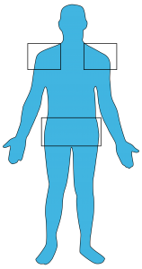Three Pain Areas of Polymyalgia Rheumatica